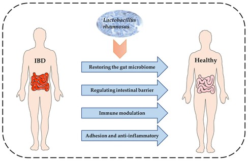 L-Rhamnose Regulates Gut Function L-Rhamnose Regulates Gut Function